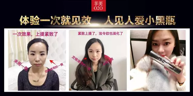 鄭州美博會(huì)_因V不凡，小黑瓶的魅力無(wú)法阻擋。